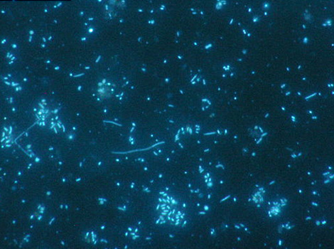 天然海水中の微生物を使った試験：細胞内の核酸染色（DAPI） 微生物対照区